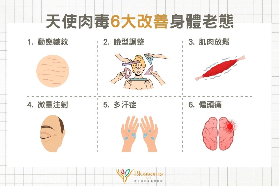 Xeomin天使肉毒改善的6個身體老態