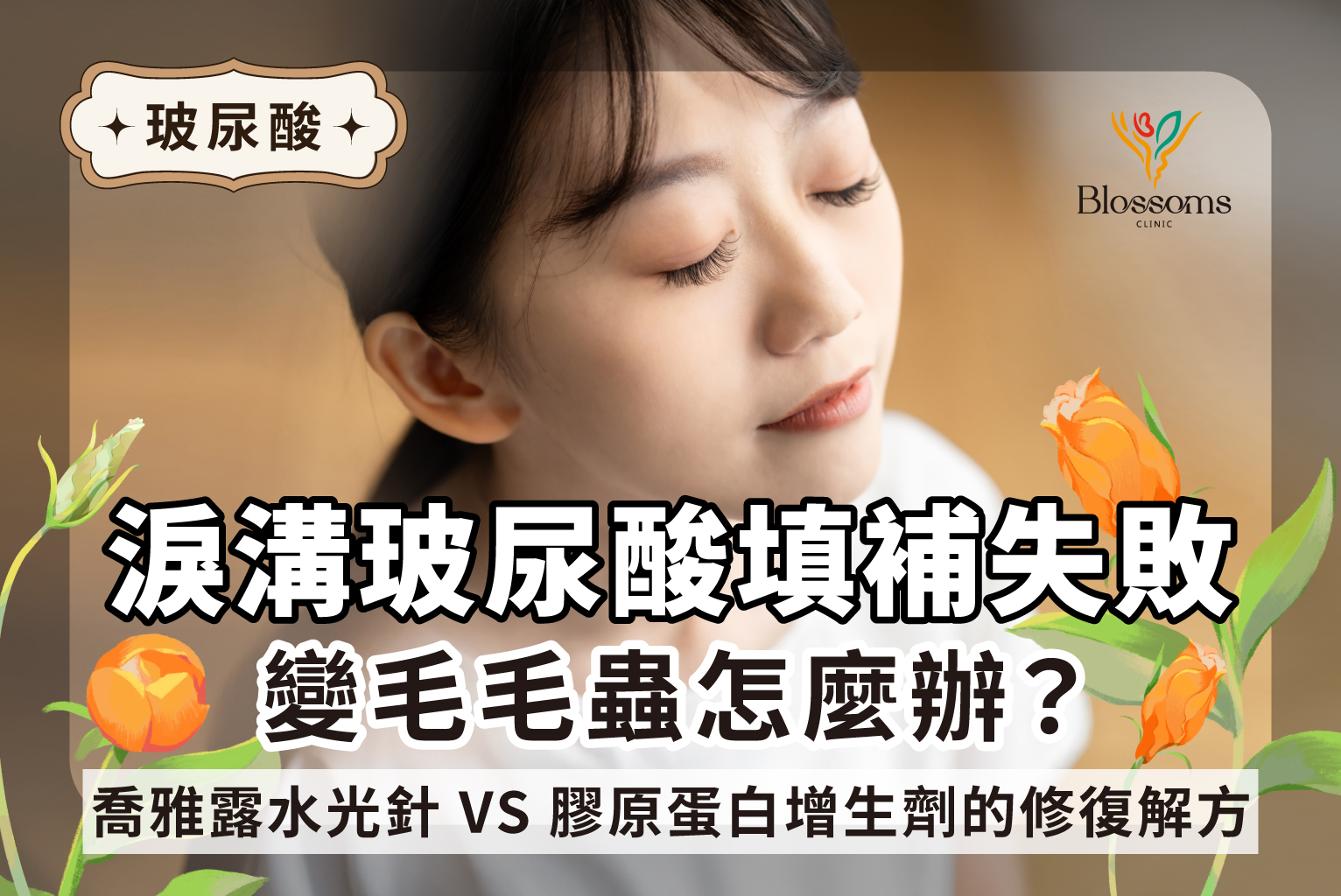 淚溝玻尿酸填補失敗變毛毛蟲怎麼辦?韓國熱門Juvelook喬雅露水光針VS.膠原蛋白增生劑的修復解方 封面圖