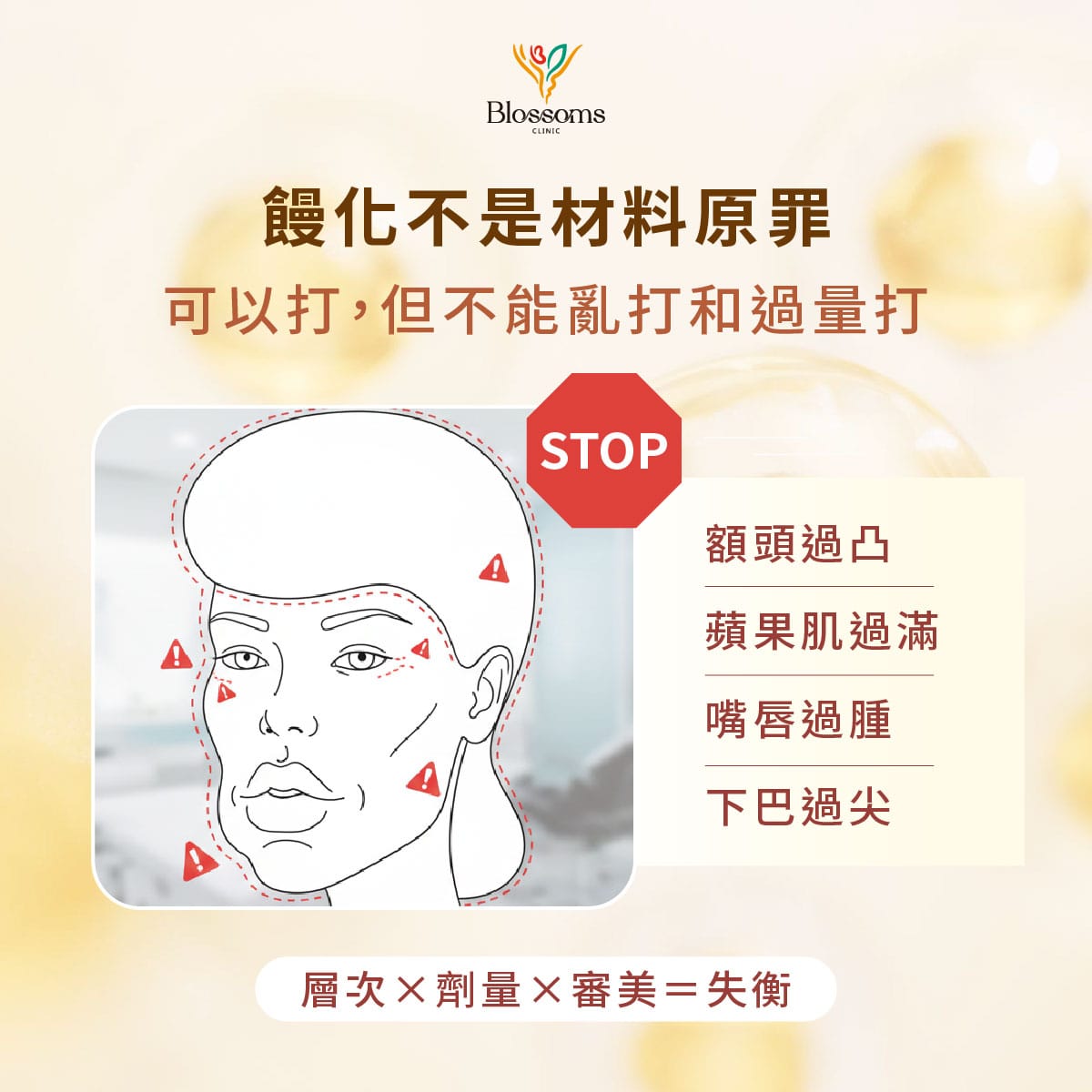 鏝化不是材料原罪 可以打，但不能亂打和過量打