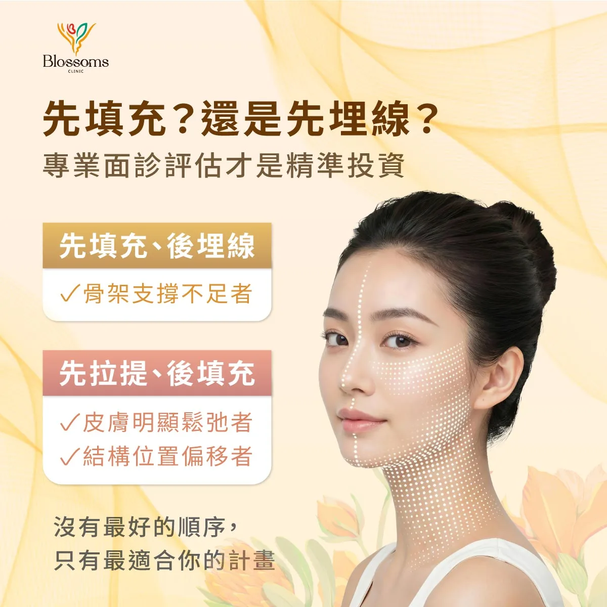 先填充?還是先埋線? 專業面診評估才是經準投資