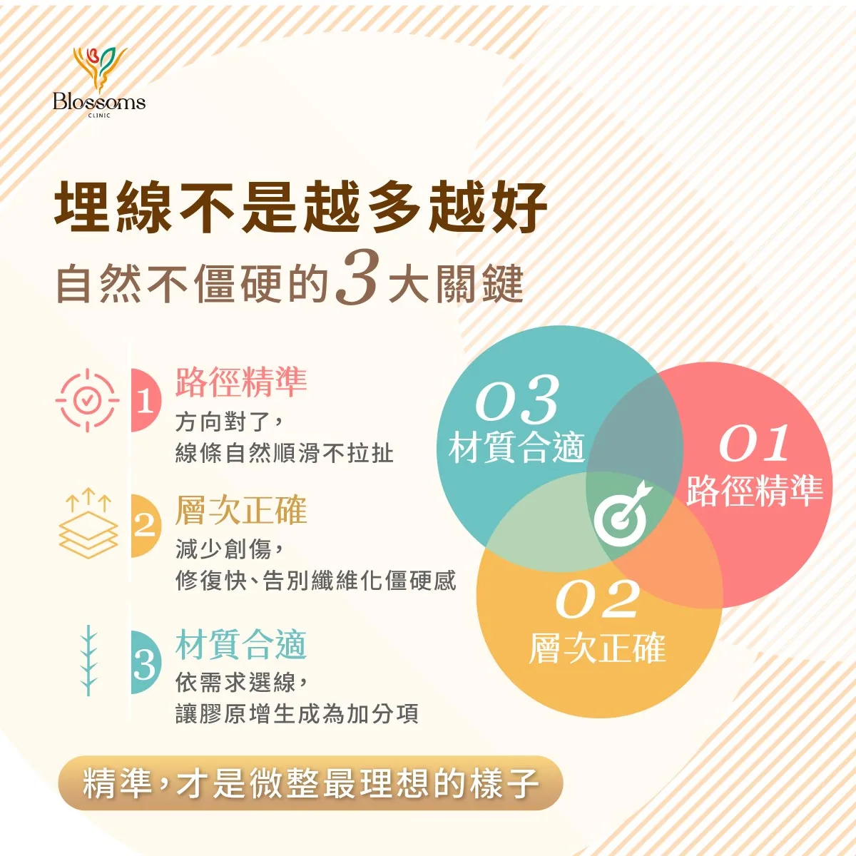 埋線不是越多越好 自然不僵硬的3大關鍵