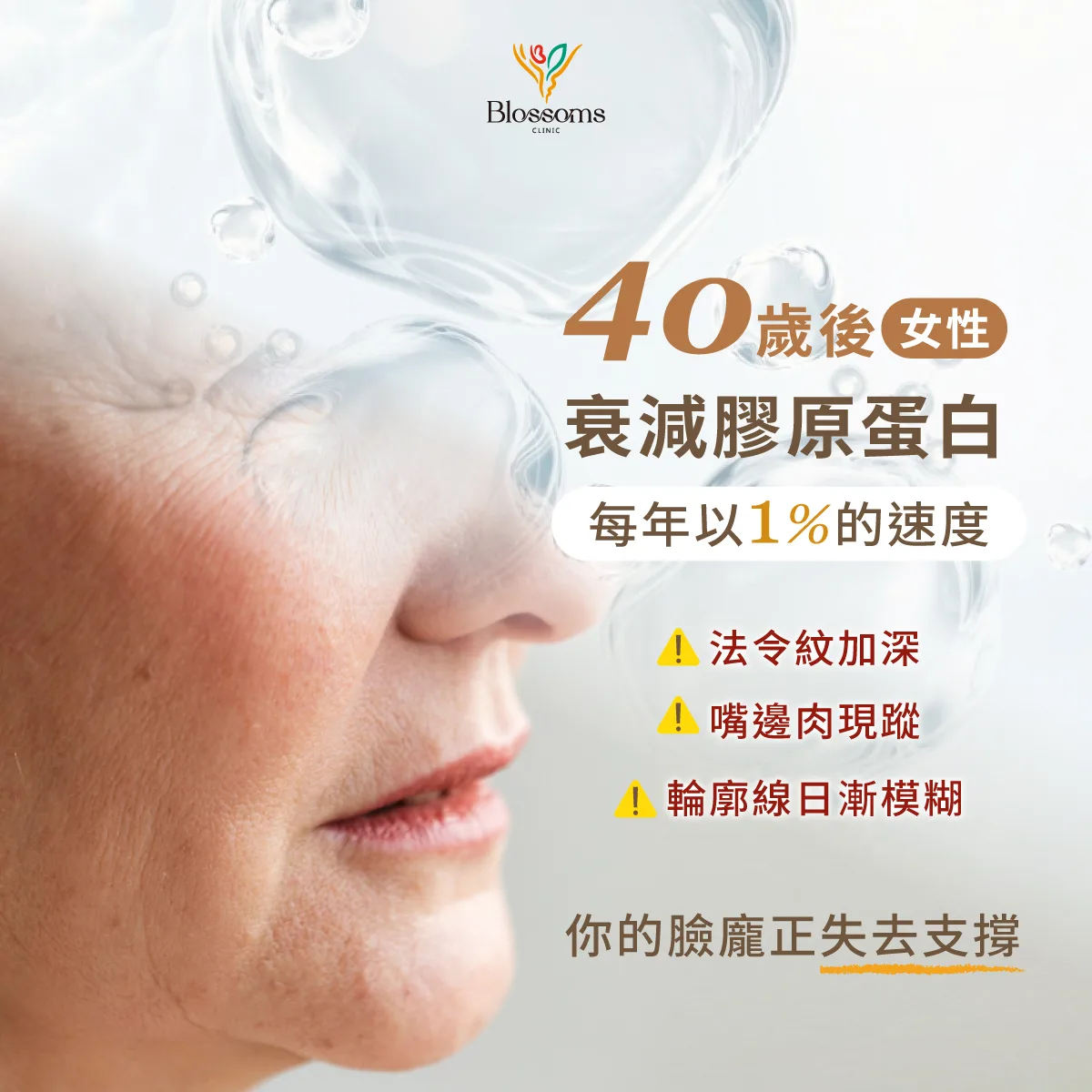 40歲後女性衰減膠原蛋白，每年以1%的速度