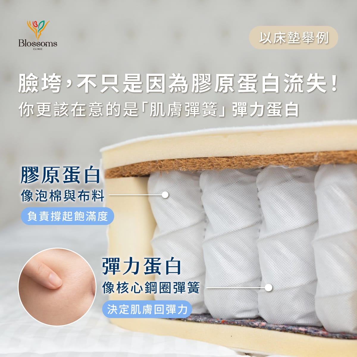 臉垮，不只是因為膠原蛋白流失!你更該在意的是肌膚彈簧彈力蛋白