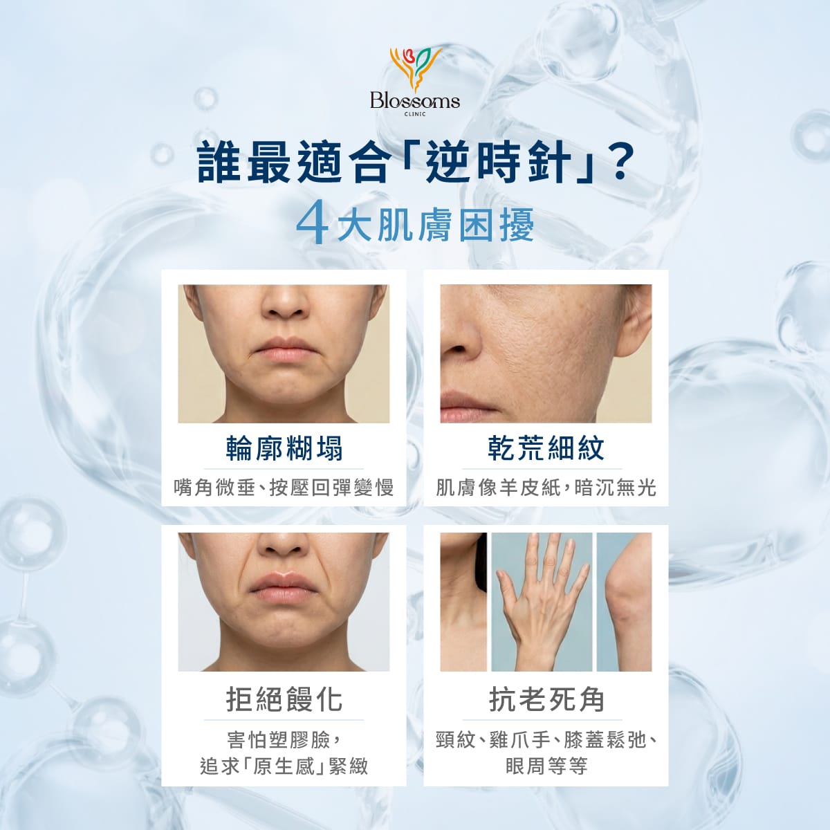 誰最適合逆時針?