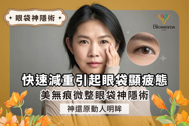 快速減重引起【眼袋】顯疲態！花千樹【美無痕微整】眼袋神隱術，神還原動人明眸 ！